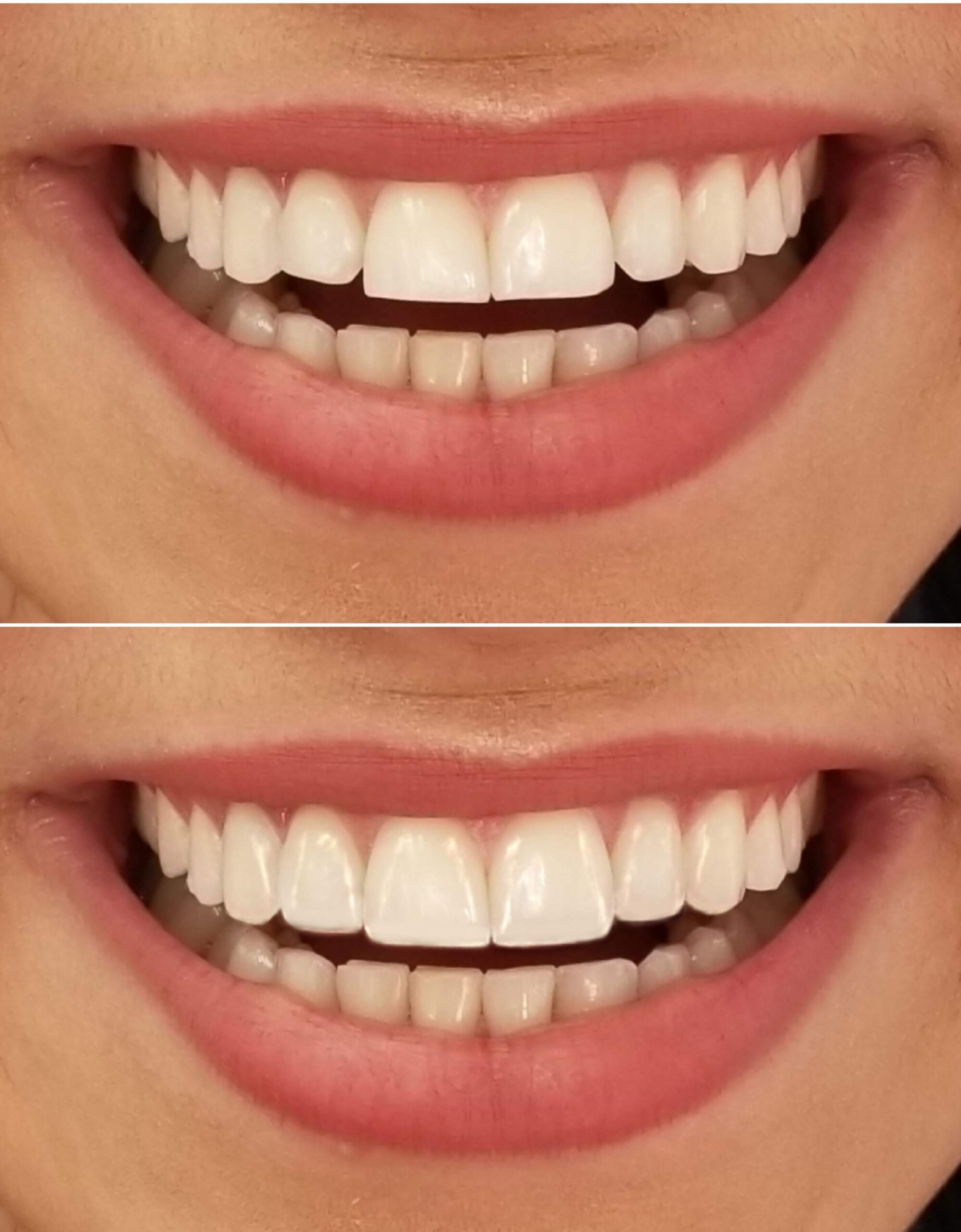 265f020df4ee61adcf520882012f649376055264