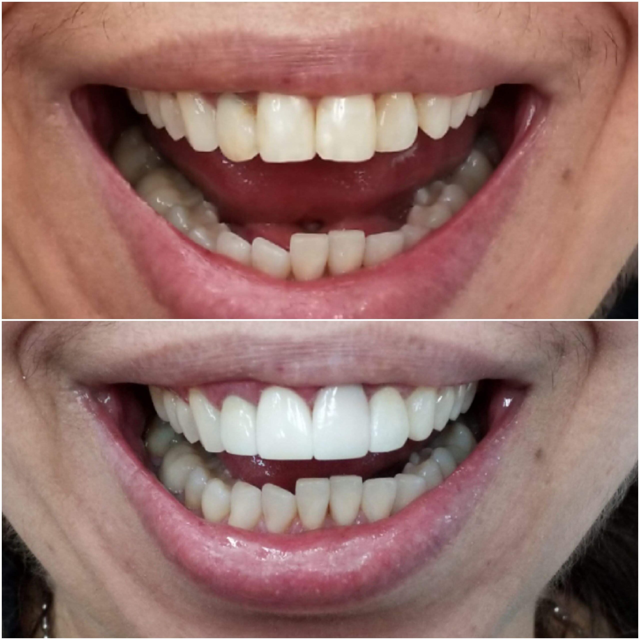 4179bda14f9c65f93a9552ddfc28a2e18810aa14