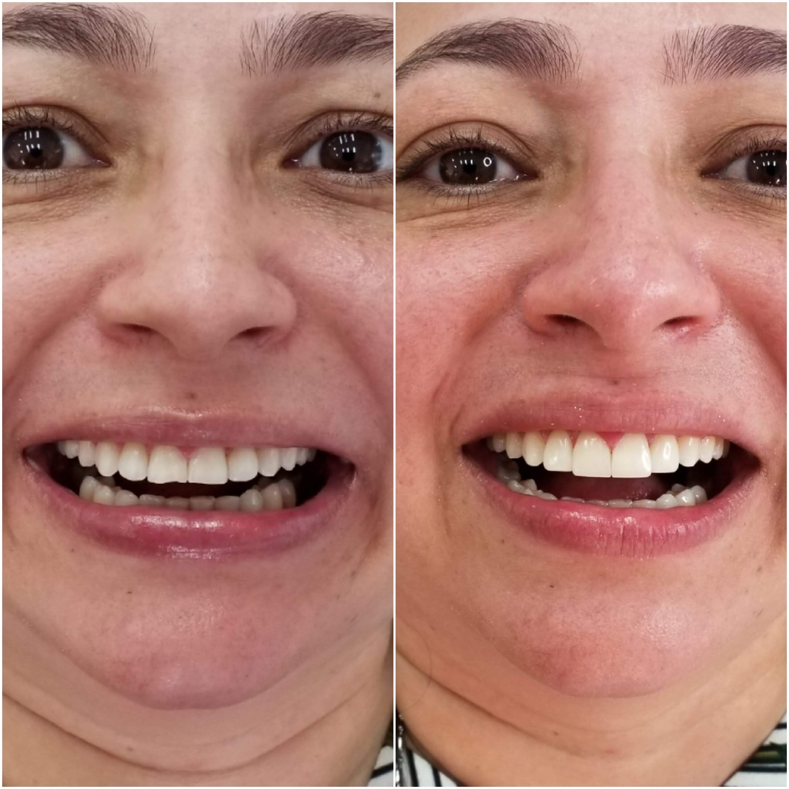 681d817ce0c6b6a49807266bb1ad9b17a65c60c8