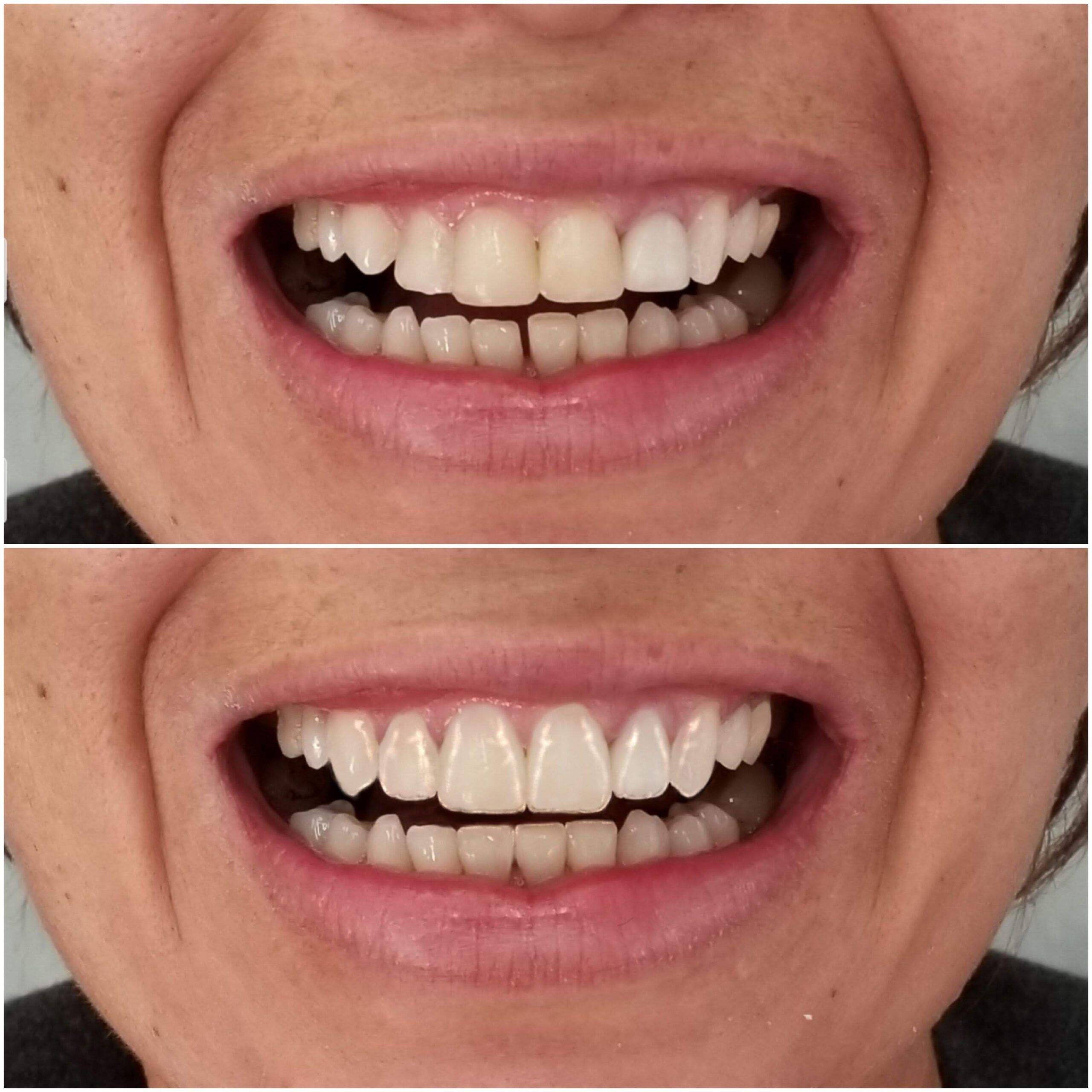 e0ba8e0cbcbdd9c118b44d9fef2caafe9295a7d8